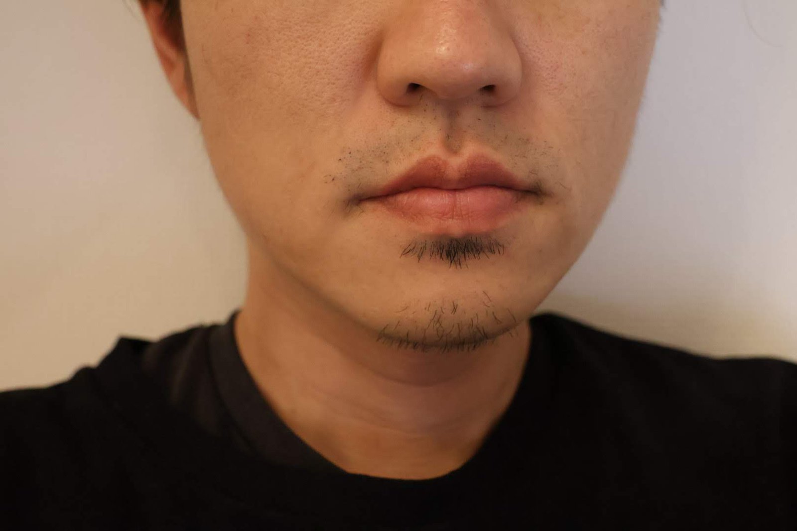 ひげが伸びた顔の下半分の写真